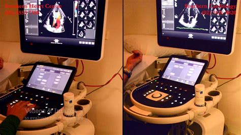 2D Echocardiogram - YouTube