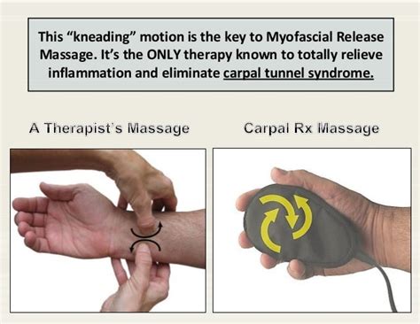 Carpal Tunnel Massage for Carpal Tunnel Syndrome