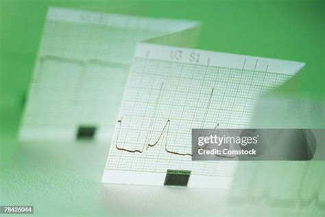 Sine Wave Ekg Photos and Premium High Res Pictures - Getty Images