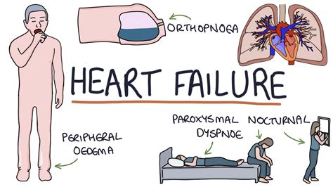 Heart Failure Cartoon - The best gifs are on giphy. - Frikilo Quesea