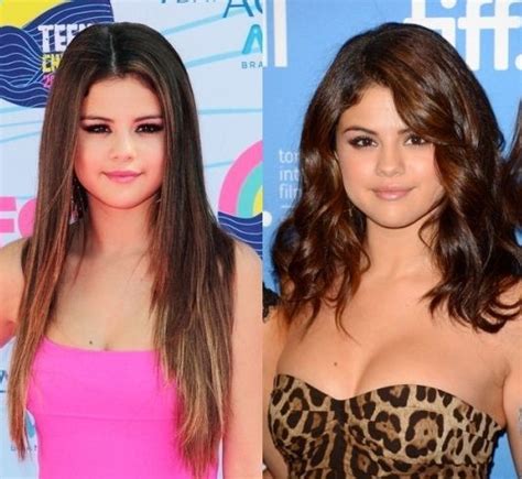 Selena Gomez Plastic Surgery for older looks!