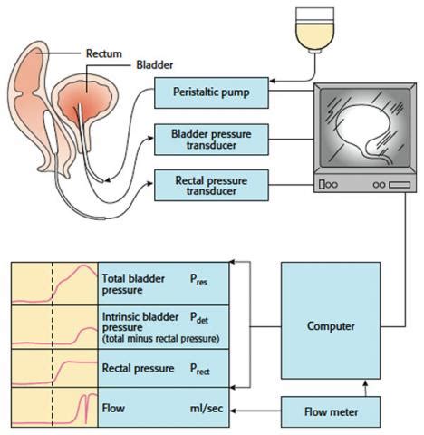 St George Urology | Urodynamic test