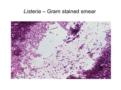 Listeria Gram Stain - Gram Stains