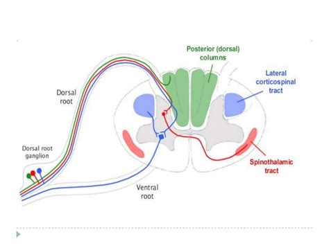 Syringomyelia ( Morvan syndrome) Electrodiagnosis | PPT