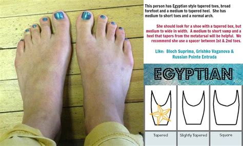 Sample Foot Types | Foot type, Feet, Type