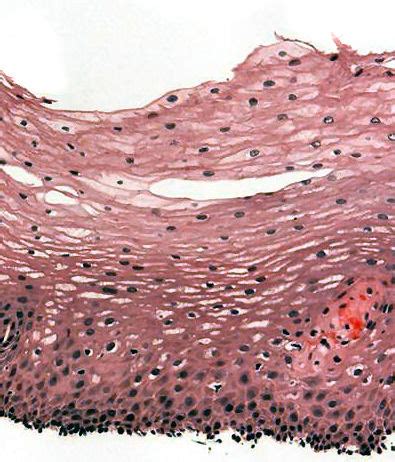 Stratified Squamous Cells