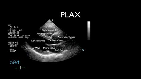 Two-dimensional (2D) Echocardiography – ECG ECHO, 46% OFF