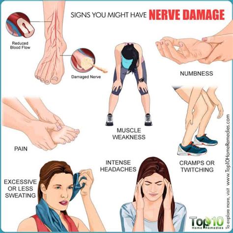 Nerve Damage: Causes, Symptoms, & Possible Complications | Nerve damage ...