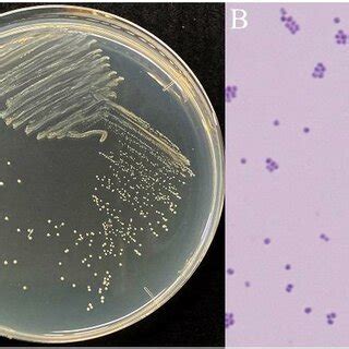 (PDF) First Report of Pediococcus acidilactici: Bacterium Harbored in Lysurus periphragmoides ...