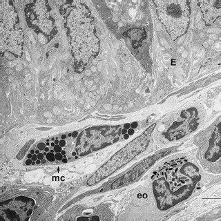 Electron microscopy of intestinal mucosa to assess epithelial damage ...