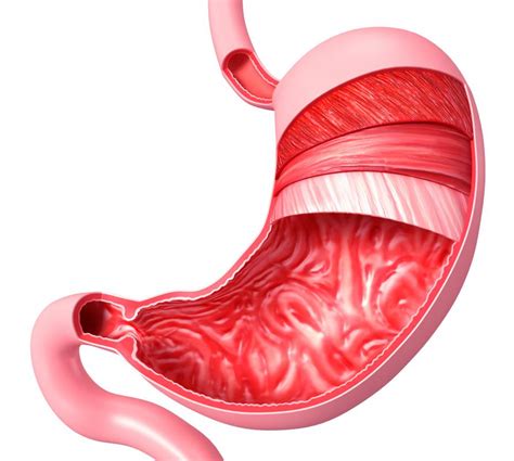 What do I Need to Know About my Stomach Lining? (with pictures)