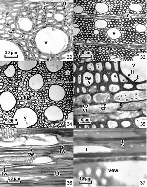 Fig. 32–37. Sections from secondary xylem of Gnetum africanum (32) and ...