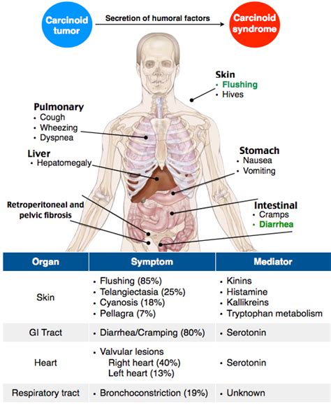 Rosh Review | Carcinoid syndrome, Neuroendocrine cancer, Medical mnemonics