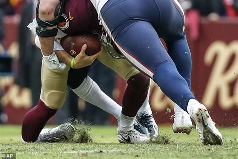 NFL star Alex Smith suffers horrific broken leg in Washington Redskins' defeat to the Houston ...