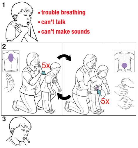 Step-by-Step: Heimlich Maneuver for a Child