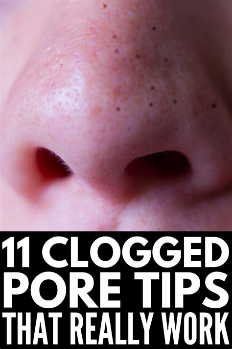 How to Get Rid of Clogged Pores: 11 Remedies & Products We Swear By | Nose pores, Clogged pores ...