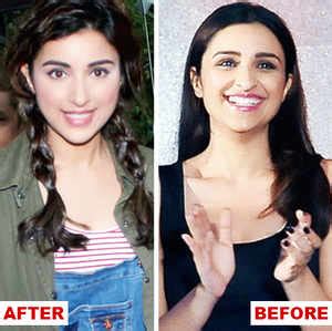 Parineeti Chopra - before and after - Mumbai Mirror