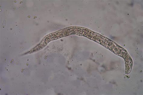 Threadworms in Cats - Symptoms, Causes, Diagnosis, Treatment, Recovery, Management, Cost