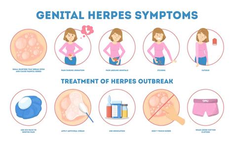 How To Soothe Genital Herpes - Flatdisk24