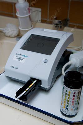 Urinalysis machine - Stock Image - C014/2154 - Science Photo Library