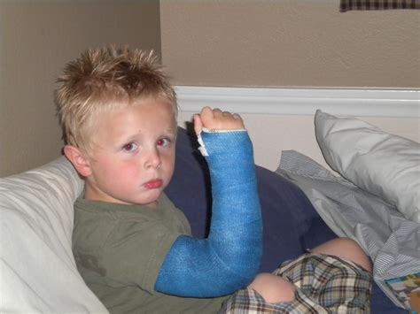 Brady's House: The Broken Arm