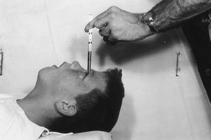 History of the lobotomy | Boing Boing