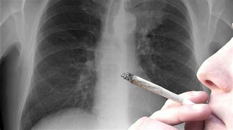 Study: smoker's lung better than none | KATV