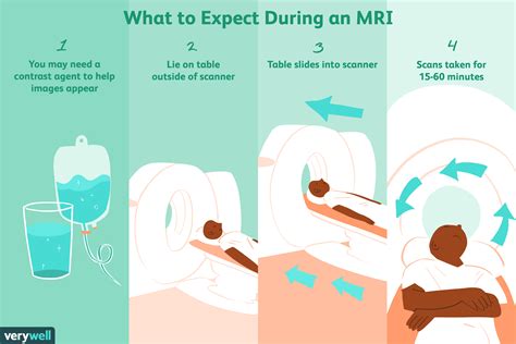 Magnetic Resonance Imaging (MRI) voor multiple sclerose - Med NL