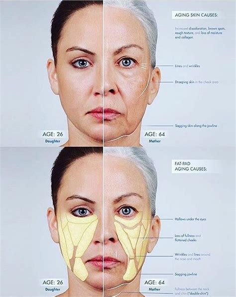 Here’s a look at what causes ageing skin. #MondayMotivation #skincare | Facial aesthetics ...