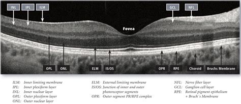 zeiss-cirrus-oct-layers – Brisbane Retina | Dr Abhishek Sharma