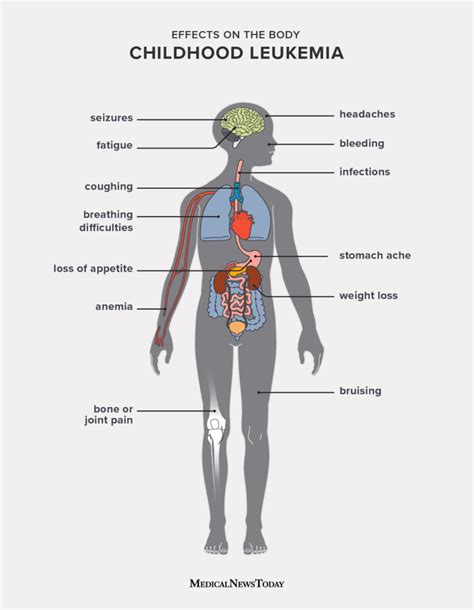 Anemia Symptoms In Children