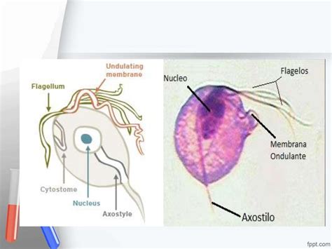 Trichomonas