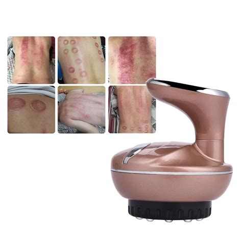 scraping massage Chinese body guasha Skin Scraping therapy machine ...