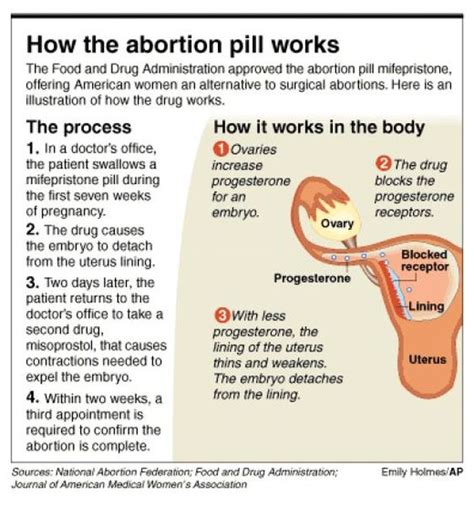 Methods Of Abortion - Abortion