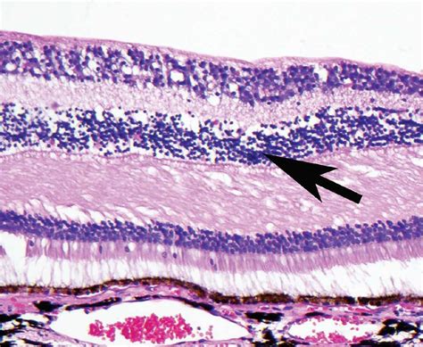 Retina Histology