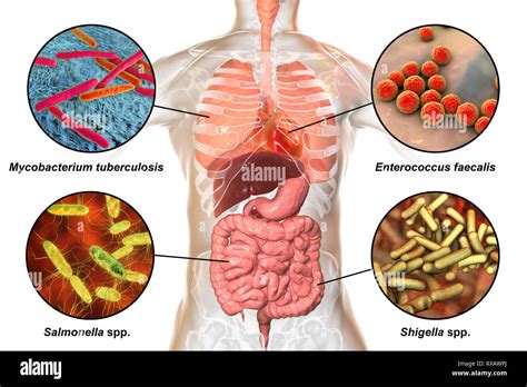 Enterococcus Faecalis Infection