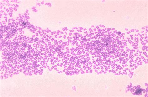 The Microorganisms: The Normal Bacterial Flora of Humans