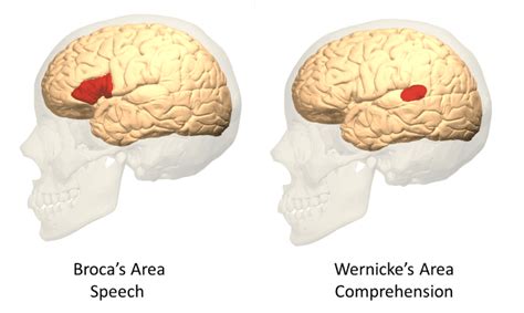 Cognitive Neuropsychology: Discoveries of Broca and Wernicke - Owlcation