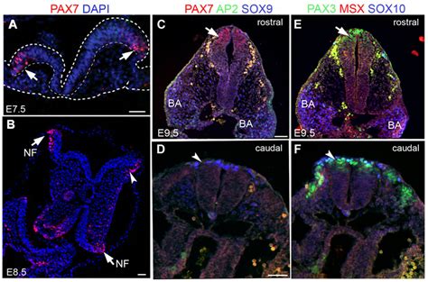 Spatiotemporal expression of neural crest markers including Pax7 in ...