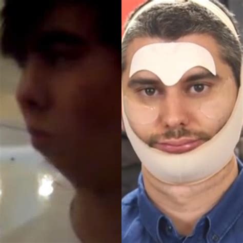 What if Leafy was just trying to get rid of his double chin this whole time? : r/h3h3productions