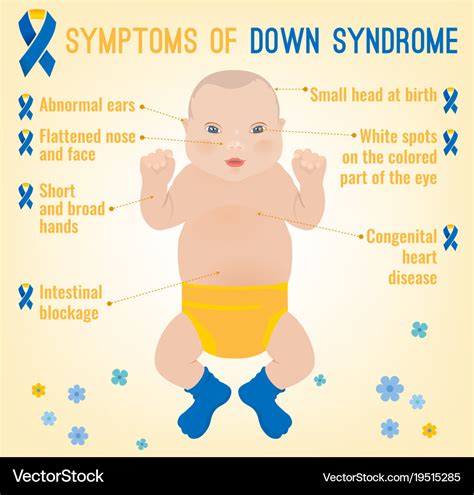 Down syndrom symptoms Royalty Free Vector Image