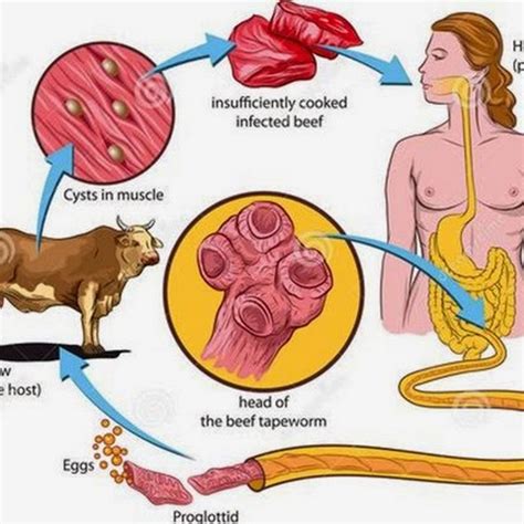 Beef tapeworm, Lifecycle, Clinical Signs, Diagnosis and Treatment | MedicoTips.Com