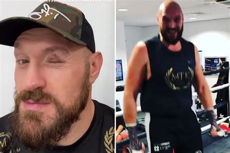 Tyson Fury shows off mystery injury above eye after sparring in training ahead of ring return on ...