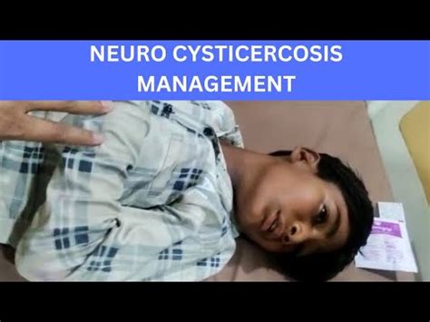 NEUROCYSTICERCOSIS | HOW TO MANAGE | LATEST GUIDELINES | Symptoms ...