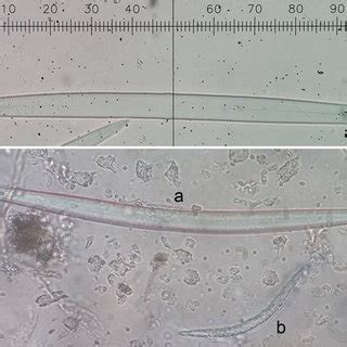 Spicules of the sampled colonies of Spongilla lacustris (a: Smooth oxea... | Download Scientific ...