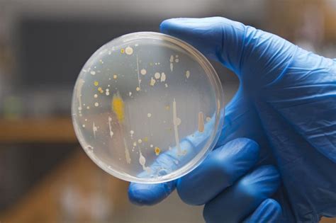 Inoculating Bacteria on Agar Plates by Streak-plating - Advancells Group