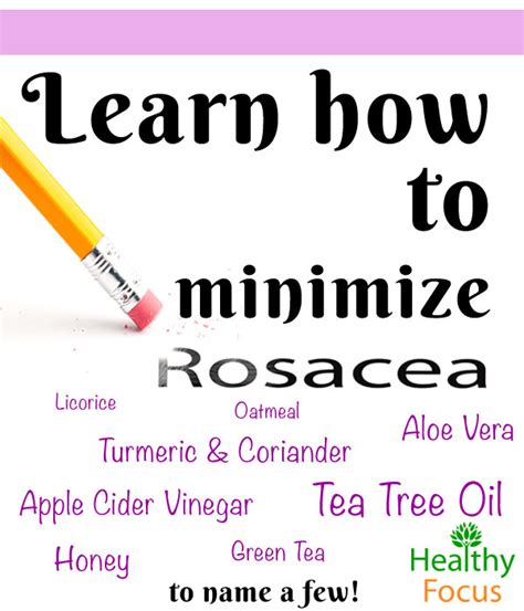 Natural Remedies for Rosacea - Healthy Focus