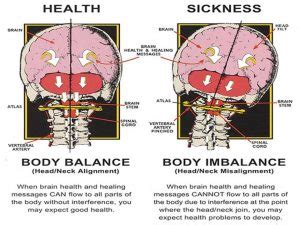 Forward head posture & headaches