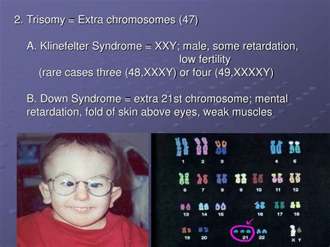 PPT - Human Genetics PowerPoint Presentation, free download - ID:1452543