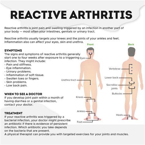 Reactive arthritis causes... - Chronic Pain Consultant Galway